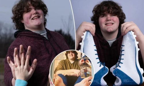 Teen sets world record for biggest feet and hands: ‘People are usually surprised’